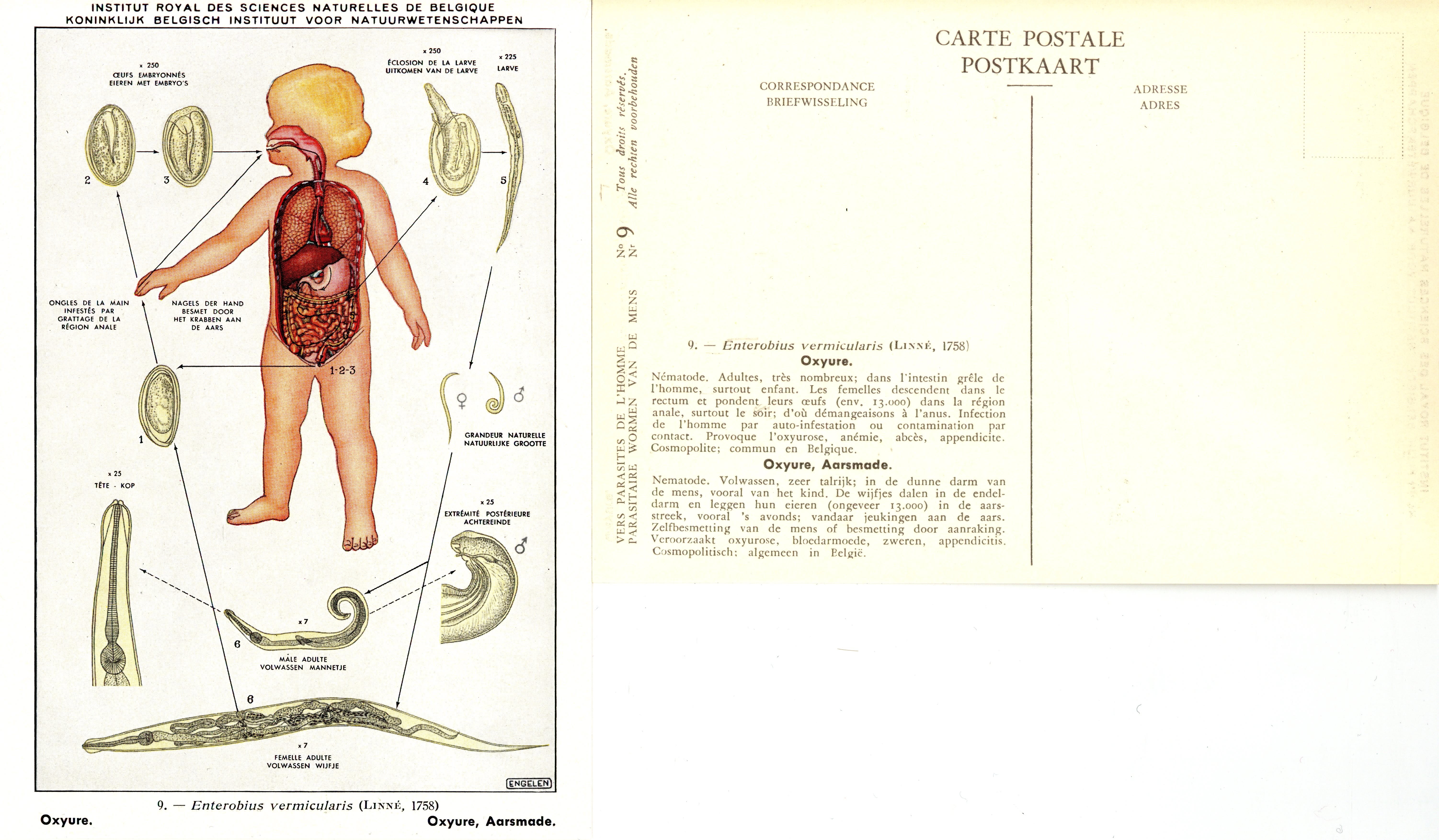 009 Enterobius vermicularis (Linné, 1758).jpg