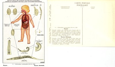 009 Enterobius vermicularis (Linné, 1758).jpg